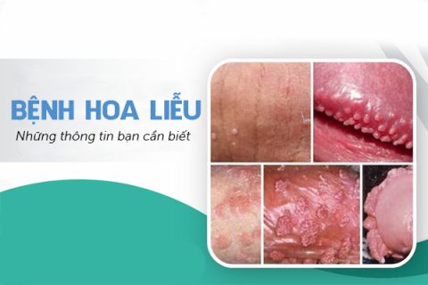 Bệnh hoa liễu Những thông tin bạn cần biết