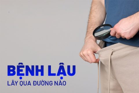 Bệnh lậu là gì Bệnh lậu lây qua đường nào