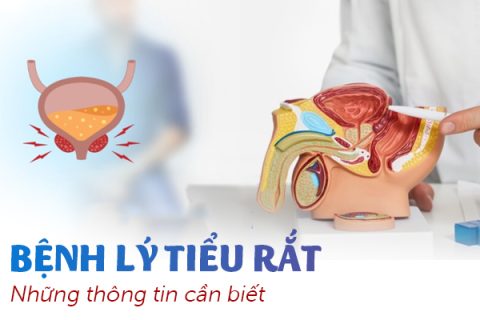 Bệnh lý tiểu rắt Những thông tin cần biết