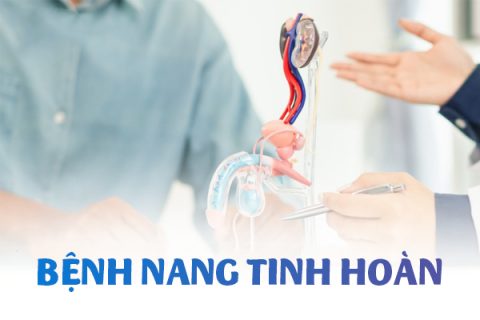 Bệnh nang tinh hoàn ở nam giới là gì