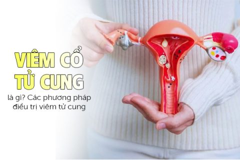 Bệnh viêm tử cung là gì Các phương pháp điều trị viêm tử cung