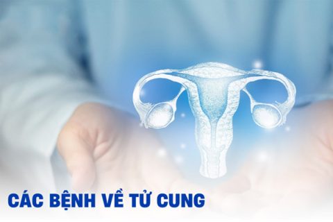 Các bệnh cổ tử cung ở nữ giới