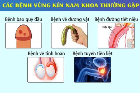 Các bệnh vùng kín nam khoa thường gặp