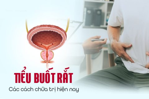 Các cách chữa trị tiểu buốt tiểu dắt hiện nay