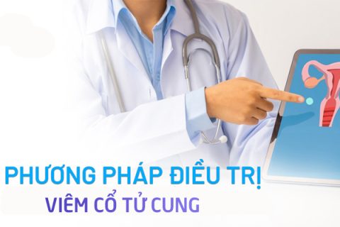 Cách chữa viêm cổ tử cung hiệu quả