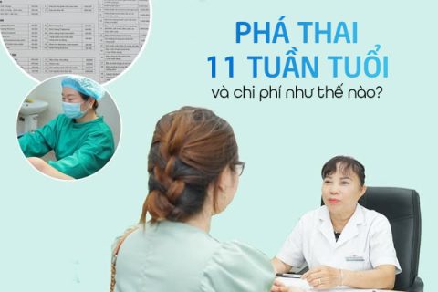 Cách phá thai 11 tuần và chi phí hết bao nhiêu