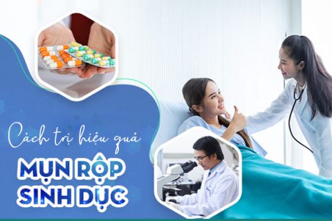 Cách trị mụn rộp sinh dục hiệu quả