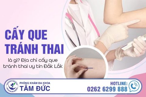 Cấy que tránh thai là gì Địa chỉ cấy que tránh thai uy tín Đắk Lắk