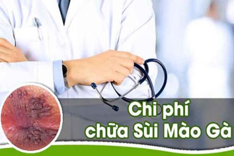 Chi phí chữa sùi mào gà là bao nhiêu