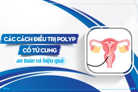Chữa trị polyp cổ tử cung bằng phương pháp nào hiệu quả