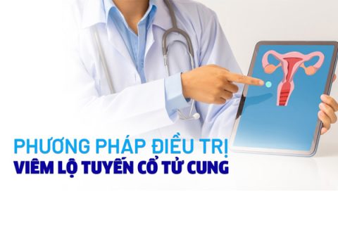 Chữa trị viêm lộ tuyến bằng phương pháp nào hiệu quả