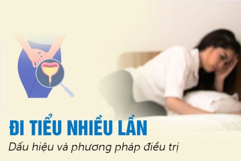 Đi tiểu nhiều lần Dấu hiệu và phương pháp điều trị