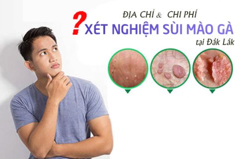 Địa chỉ và chi phí xét nghiệm sùi mào gà tại Đắk Lắk