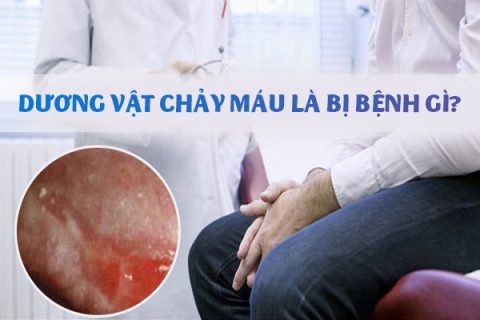 Dương vật chảy máu là bị bệnh gì