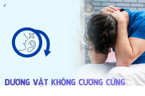 Dương vật không cưng cứng ở nam giới