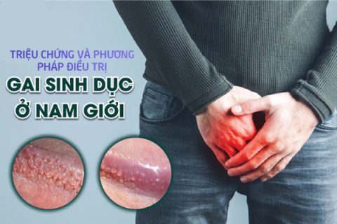 Gai sinh dục nam Triệu chứng và phương pháp điều trị