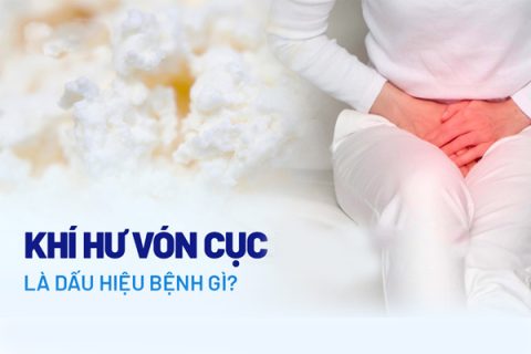 Khí hư ra dịch vón cục là biểu hiện của bệnh lý gì
