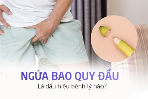 Ngứa bao quy đầu là dấu hiệu bệnh lý nào