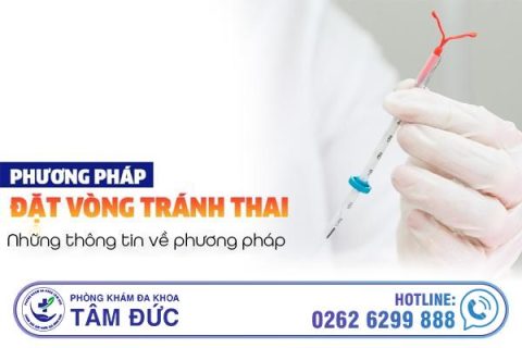 Những thông tin về đặt vòng tránh thai