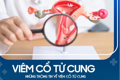 Những thông tin về viêm cổ tử cung