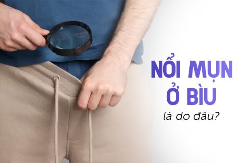 Nổi mụn ở bìu là do đâu
