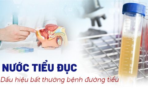Nước tiểu đục Dấu hiệu bất thường bệnh đường tiểu