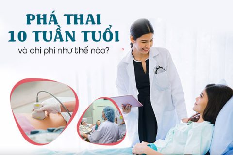 Phá thai 10 tuần tuổi và chi phí như thế nào