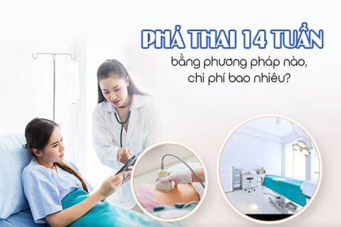 Phá thai 14 tuần bằng phương pháp nào chi phí bao nhiêu