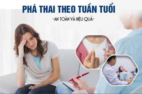 Phá thai theo tuần tuổi an toàn hiệu quả