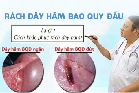 Rách dây hãm bao quy đầu là gì Cách khắc phục rách dây hãm
