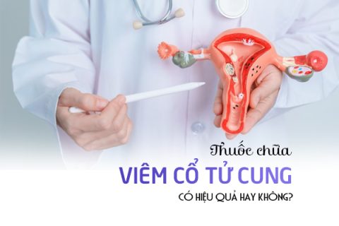 Thuốc chữa viêm cổ tử cung hiệu quả không