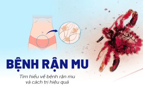 Tìm hiểu về bệnh rận mu và cách trị hiệu quả