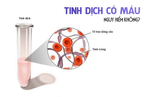 Tinh dịch có máu nguy hiểm không