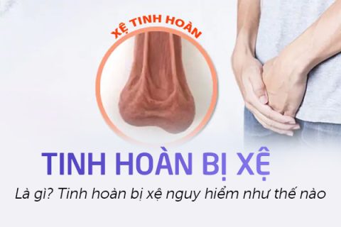 Tinh hoàn bị xệ là gì Tinh hoàn bị xệ nguy hiểm như thế nào