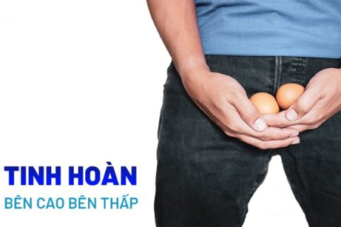 Tình trạng tinh hoàn bên cao bên thấp có sao không