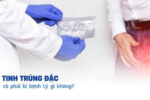 Tinh trùng đặc có phải bị bệnh lý gì không