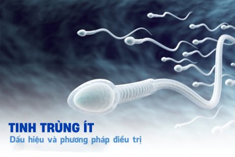 Tinh trùng ít Dấu hiệu và phương pháp điều trị