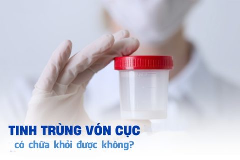 Tinh trùng vón cục có chữa khỏi được không