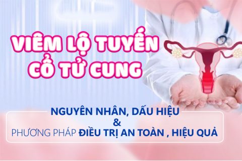 Viêm lộ tuyến Dấu hiệu nguyên nhân và cách trị
