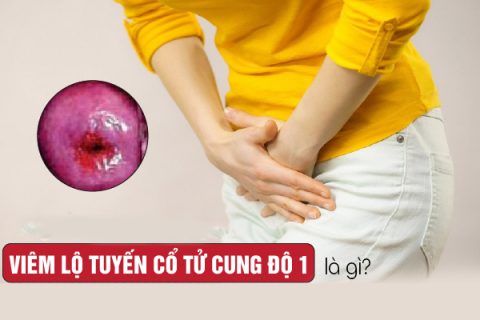 Viêm lộ tuyến cổ tử cung cấp độ 1 là gì