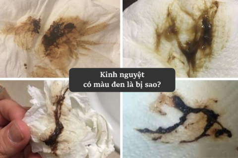 kinh-nguyet-co-mau-den