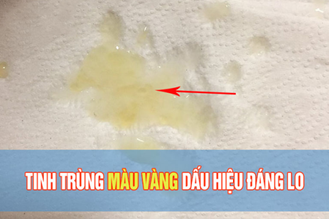 tinh-trung-co-mau-vang